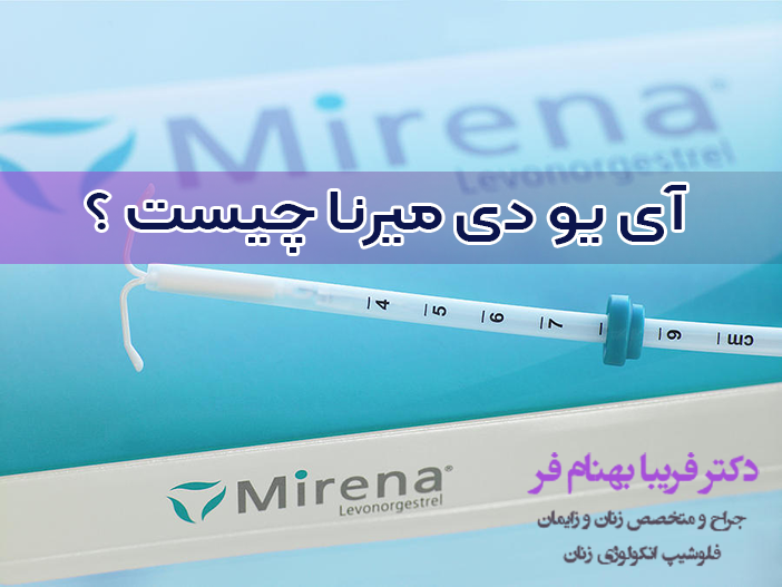 آی یو دی میرنا چیست ؟