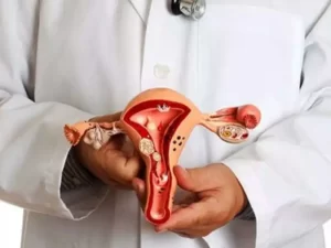 درمان توده های تخمدان و لگن