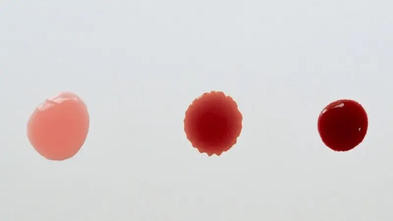 درمان خونریزی غیر طبیعی زنان