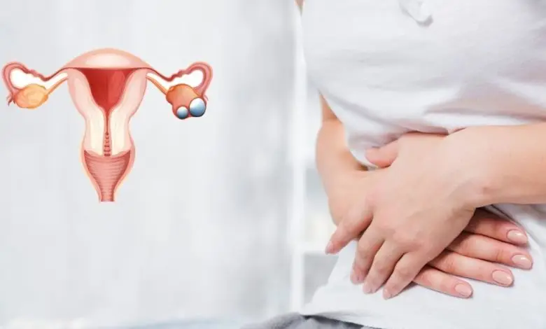 درمان قطعی تنبلی تخمدان