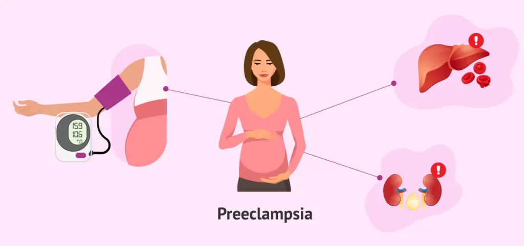 تشخیص مسمومیت حاملگی یا پره اکلامپسی