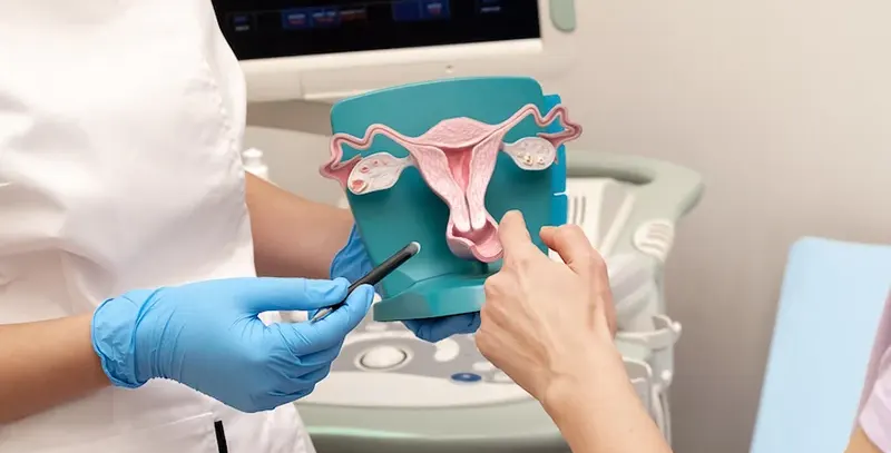 علائم فیبروم در مقابل علائم کیست تخمدان