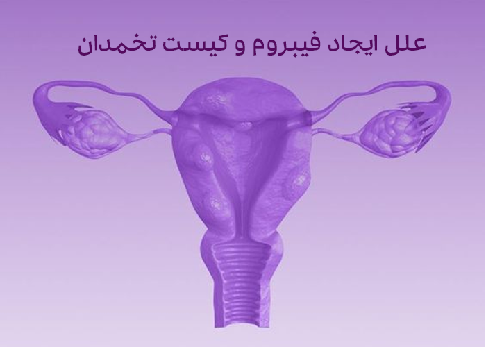 علل ایجاد فیبروم و کیست تخمدان